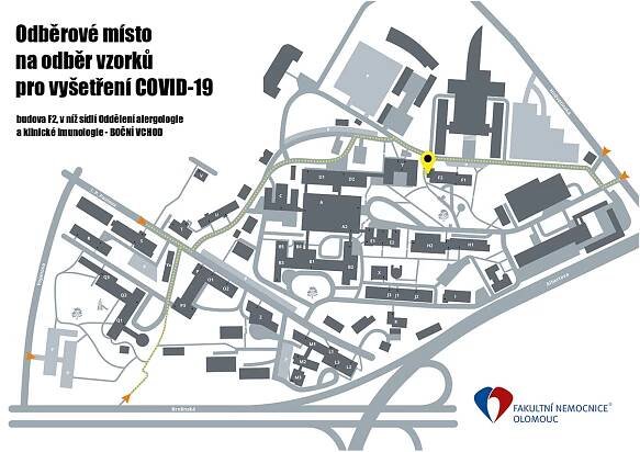 UPOZORNĚNÍ: Úprava provozní doby odběrového místa | Fakultní nemocnice Olomouc
