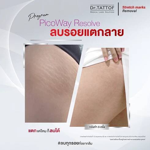 รอยแตกลาย