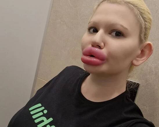 Andrea Ivanova (24) se rozhodla chce mít největší rty na světě - ProSvět.cz