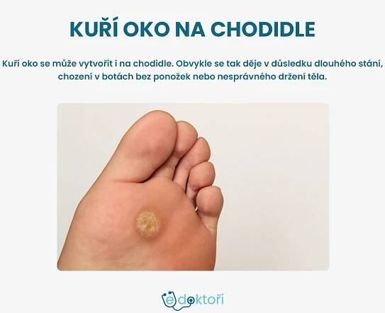 Autor: Redakce edoktori.cz