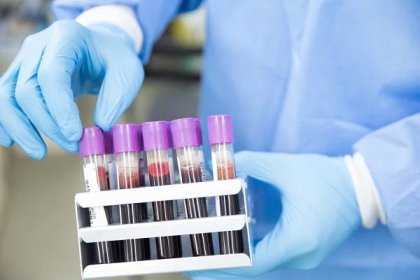 Univerzální krevní test odhalí z krve přes 50 typů rakoviny | 100+1 zahraniční zajímavost