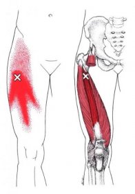 Bolest přední strany stehna - příčiny - Spoušťovýbod