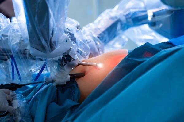 Laparoskopická operace představuje moderní chirurgickou metodu, která umožňuje provádět zákroky s minimálním zásahem do těla pacienta. Tento typ operace je prováděn pomocí speciálního nástroje zvaného laparoskop, který je zaveden do těla přes malé řezy. Díky tomu je minimalizováno riziko infekce, zkracuje se doba rekonvalescence a snižuje se bolest po operaci. Laparoskopická operace je využívána při různých typech chirurgických zákroků, včetně gynekologických, gastrointestinálních a urologických operací, což z ní činí důležitou součást moderní medicíny.