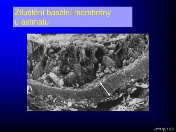 PPT - PATOGENEZE BRONCHIÁLNÍ OBSTRUKCE ASTMA, CHOPN PowerPoint Presentation - ID:3773280