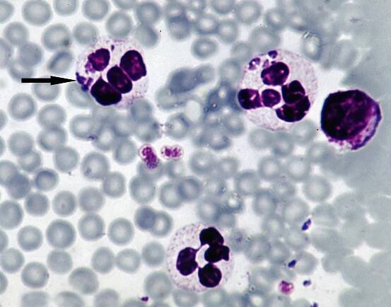 Soubor:Anaplasma-phagocytophilum-sheep.jpg – Wikipedie