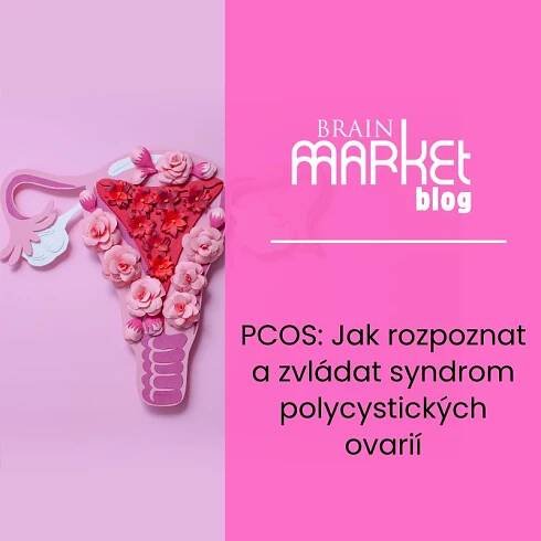 PCOS: Jak rozpoznat a zvládat syndrom polycystických ovarií