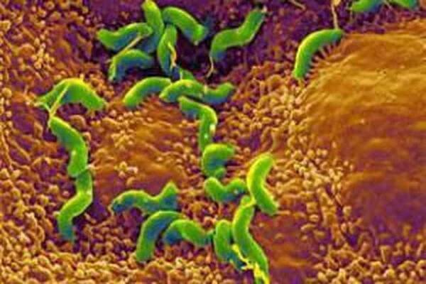 Příčiny, symptomy, rozsah a léčba stafylokoků. Jak se přenáší? / Staphylococcus