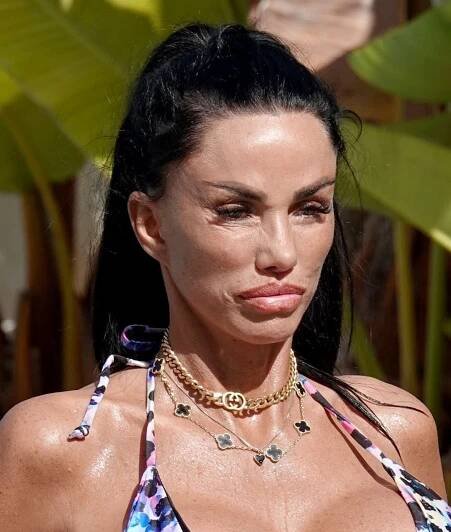 Katie Price vystavila své obří silikony v bikinách! Takhle vypadají její vnady po sedmnácté operaci a tvář po faceliftu