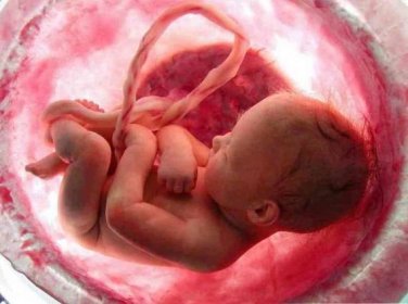 Zpomalení intrauterinního vývoje plodu příčiny, rozsah, důsledky / Matka a dítě