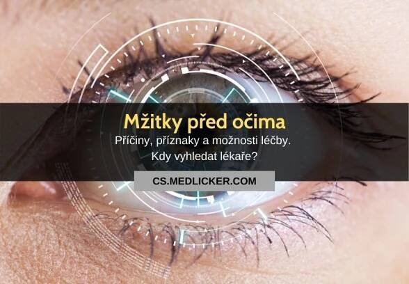 Mžitky před očima: vše co potřebujete vědět