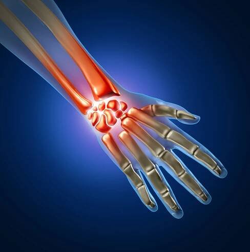 What is Wrist Arthroscopy?
