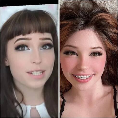 /w/ - Belle Delphine/ Mary Belle Kirschner #9: Failed Marketing Stunts & Implants Edition