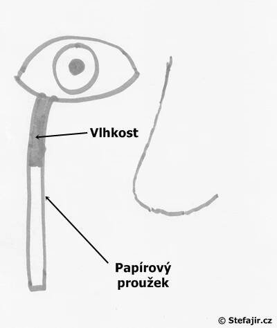Sjögrenův syndrom | Medicína, nemoci, studium na 1. LF UK