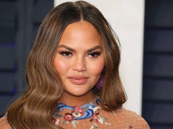 Chrissy Teigen’s Lips Got Crazy Swollen Thanks to Altitude Sickness, Apparently