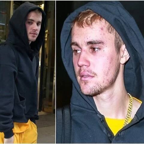 Justin Bieber děsí všechny svoje fanoušky. Vypadá jako uživatel pervitinu!