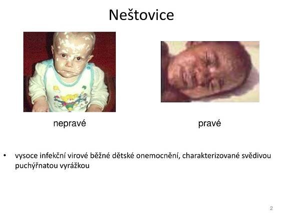 PPT - Nemoci a poškození kůže PowerPoint Presentation, free download - ID:4714267