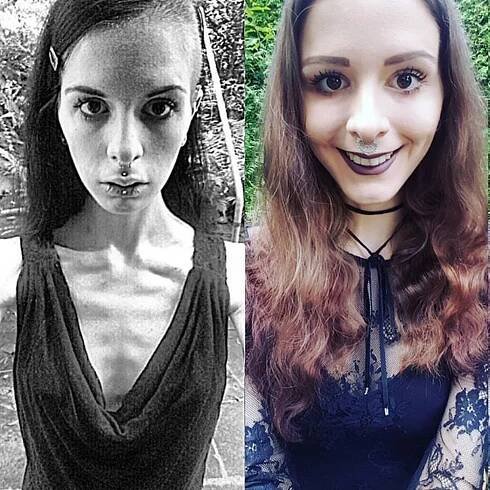 Julie trpěla anorexií. Aby nemusela jíst, schovávala si jídlo do uší