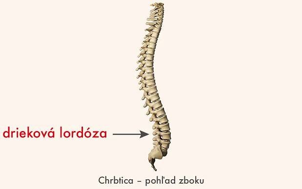 driekova lordoza