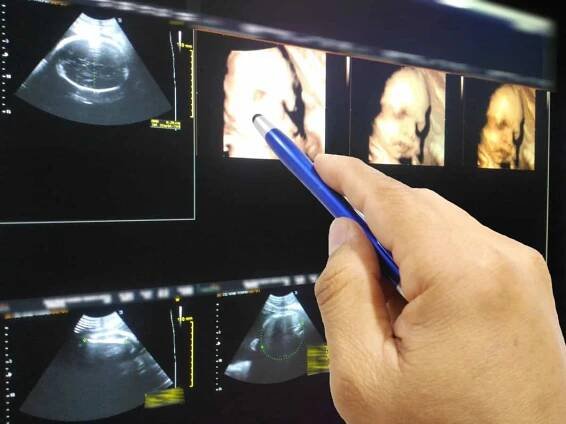 3d ultrazvuk kada se radi - Arz.hr