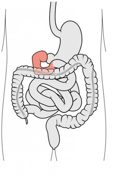 Schematický diagram gastrointektinálního traktu; dvanáctník znázorněn růžově
