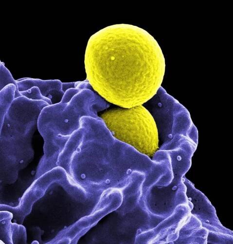 Drug-resistant superbugs: A global threat intensified by the fight against coronavirus – Medical Equipment for Sale