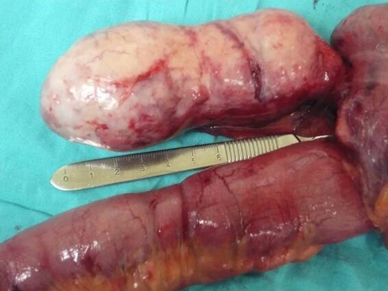 Etc, Etc. - El Atlas Gastrointestinal - gastrointestinalatlas.com