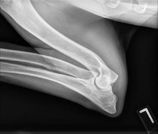 Lenore's Left Elbow