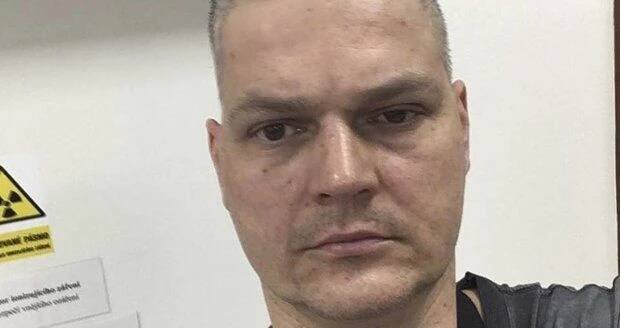 Petr Vlasák dochází na ozařování.