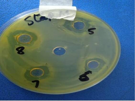 Figure 14. Inhibition zone by methanol extracts in S. aureus inoculated plate. 
