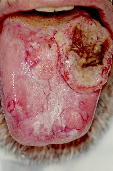 File:PLoS oral cancer.png - Wikimedia Commons