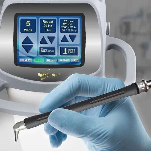 Lasers in Dentistry - Why a CO2 Dental Laser? - LightScalpel