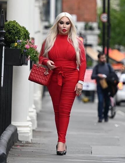 Přeoperovala se z Kena na Barbie, teď řeší váhu: Jessica měla 102 kg, chce být glamour modelkou