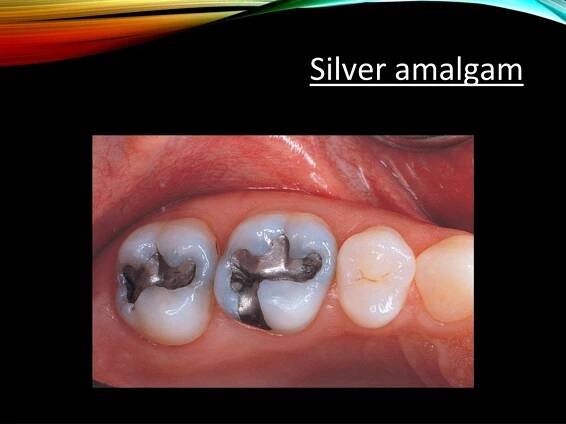 PPT - Introd uction to dental materials PowerPoint Presentation, free download - ID:211626