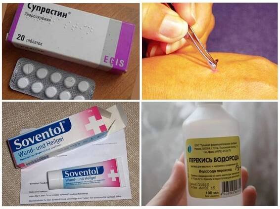 Pomozte dítěti kousnout včelu