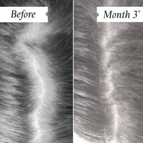 Density - Clinically Proven to Help Slow Hair Loss | Philip Kingsley