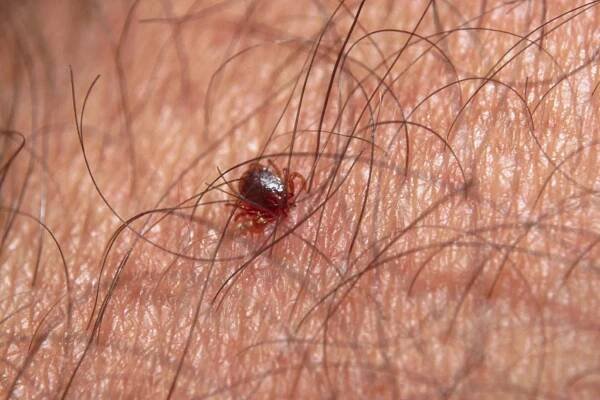 A red-brown tick on white skin, surrounded by brown hairs. The tick has a small oval body and 8 legs.