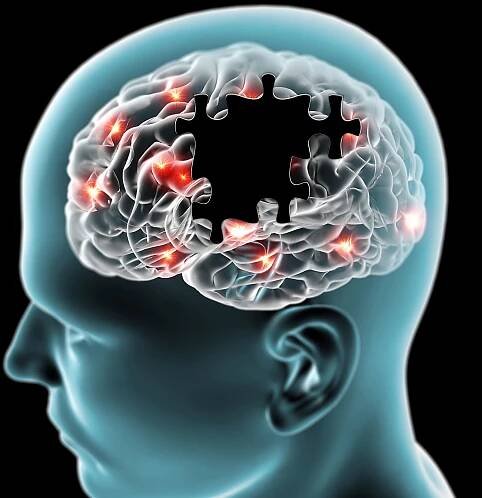 Family history impacts Alzheimer's more than you realize