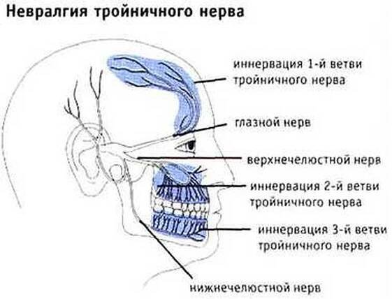 Neuritis (zánět) trigeminálního nervu / Trigeminální nerv