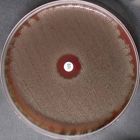 Methylene Blue stain
