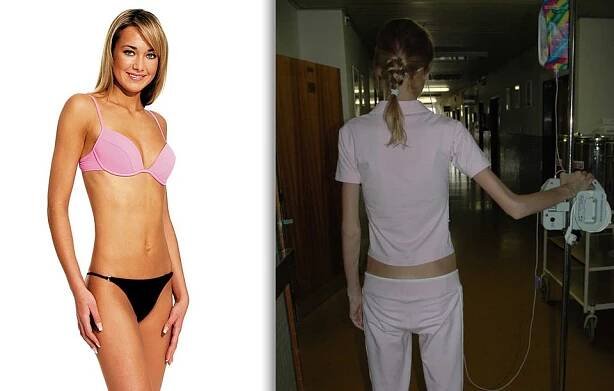 Další modelka, která bojovala s anorexií: Pavla Sudová vážila jen 34 kilo!