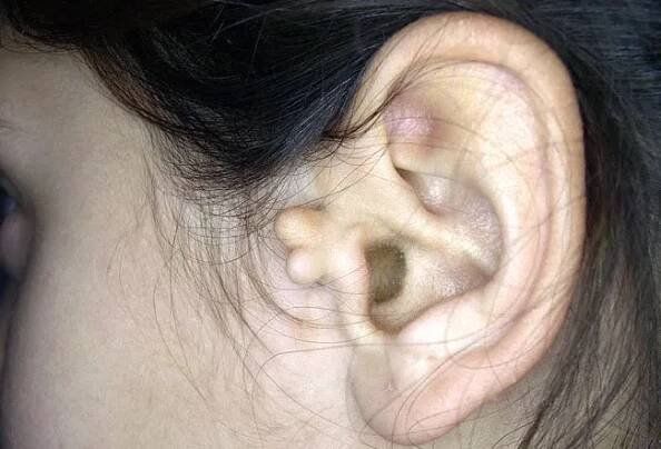Picture of Auricular Tags 