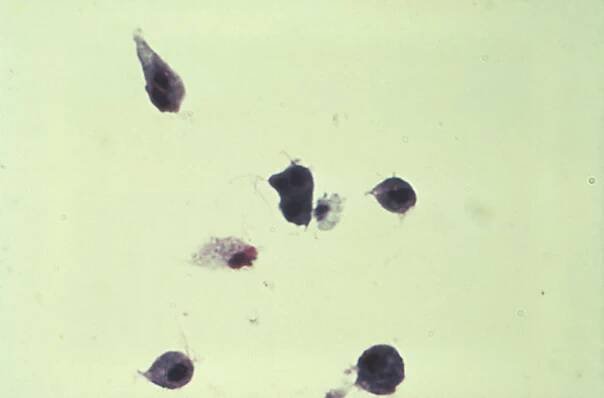 Trichomonády