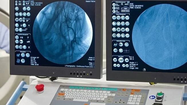 Angiografie slouží k zobrazení cévního řečiště. Jak vyšetření probíhá?