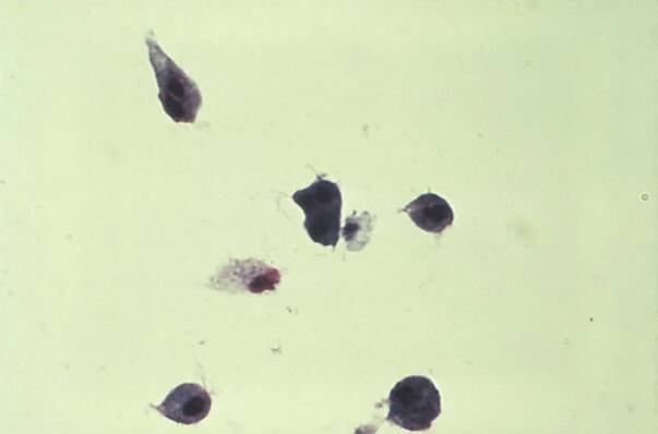 Soubor:Trichomonas vaginalis 01.jpg – Wikipedie