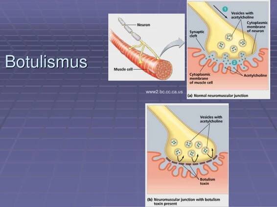 PPT - Lékařská mikrobiologie pro ZDRL PowerPoint Presentation, free download - ID:4434831