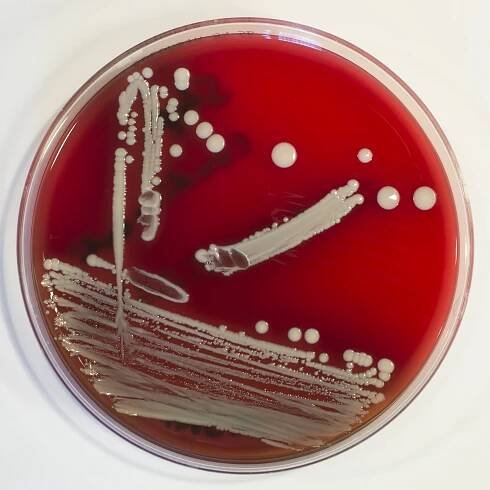 Staphylococcus condimenti