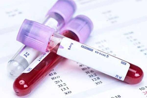 Glykovaná rychlost hemoglobinu v analýze krve /