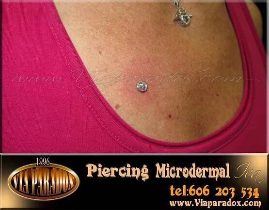 Microdermal - Via Paradox