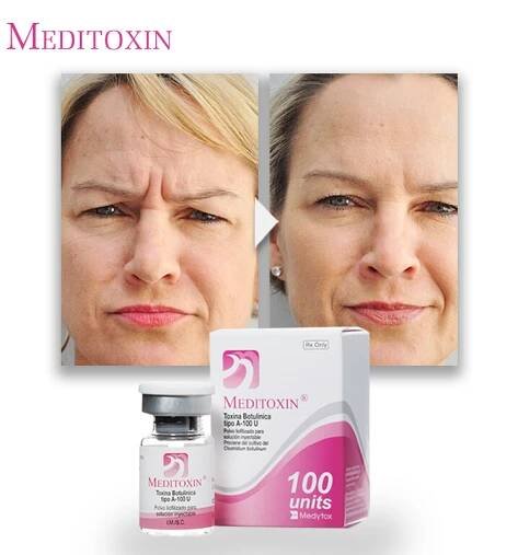 buy Botulinum Toxin online 50 units