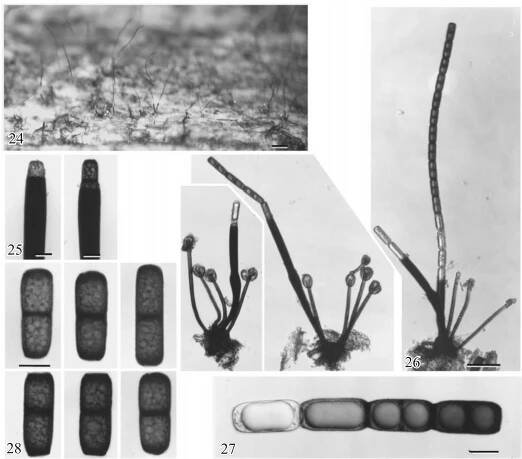 Figs 24-28. Sporoschisma uniseptatum. Fig. 24. A representative portion of the colony on test block. Note the long chains of adhering conidia; Fig. 25. Apical portion of phialides; Fig. 26. Conidiophores with basal setae and conidial chain; Fig. 27. Chain of conidia; Fig. 28. Conidia. Scale bars: Fig. 24 = 100 um; Figs 25, 27, 28 = 10 um; Fig. 26 = 50 um. 